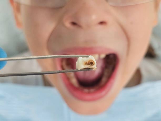 Best Tooth Infection Emergency Dentist  in Greenock, PA